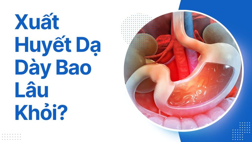 xuất huyết dạ dày bao lâu thì khỏi